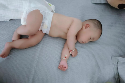 乌兰察布宝宝头上长痱子